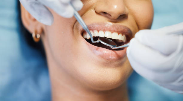 Best Urgent Care for Lost Fillings or Crowns in Artesia, CA